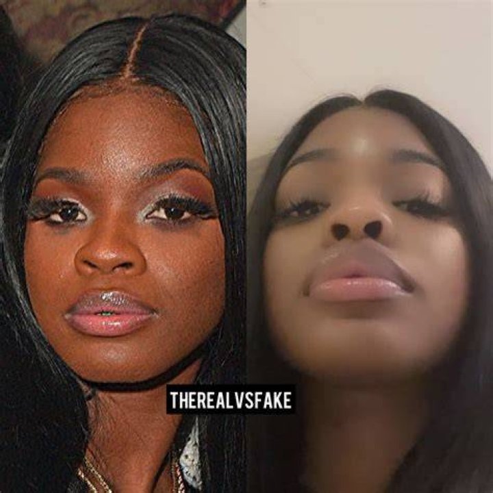 City Girls JT Before And After | Nose Job And BBL