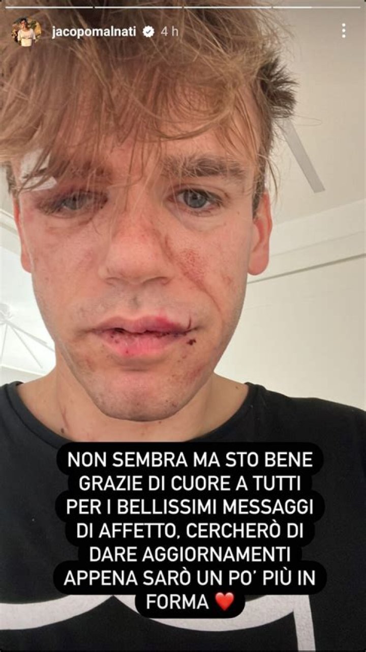 Jacopo Malnati